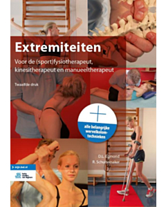 Extremiteiten