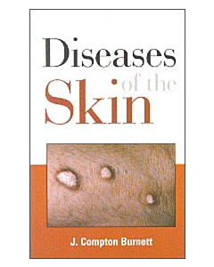 Diseases of Skin